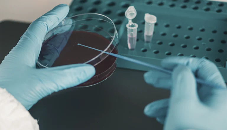 Terapia Conservativa dell’artrosi di anca e ginocchio con cellule staminali